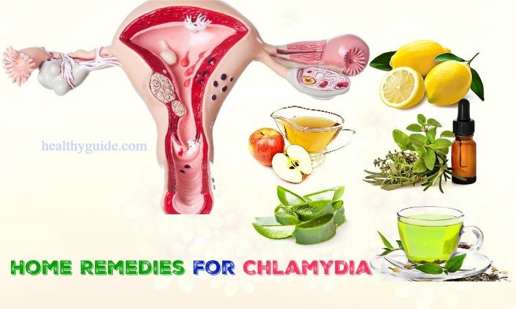 25 Fast Home Remedies for Chlamydia Infection &  Itching in ...