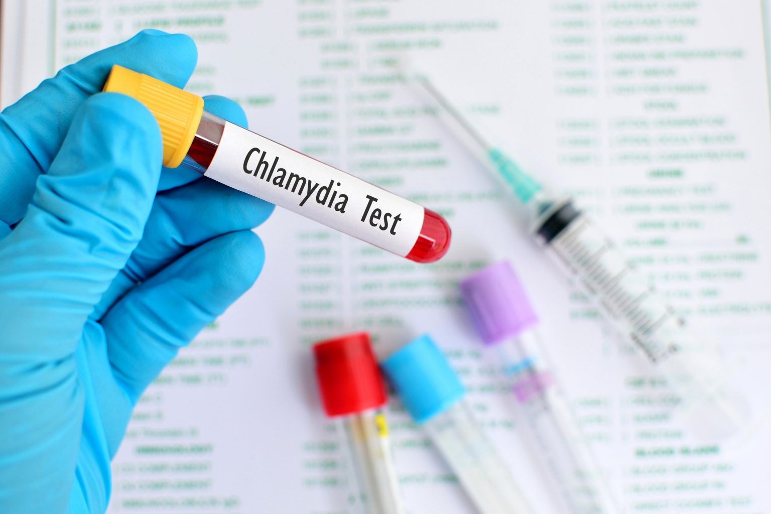 3 Signs that Indicate you are Infected with Chlamydia