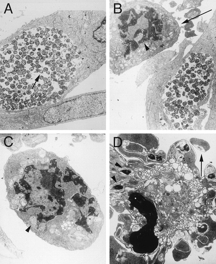 Apoptosis of Epithelial Cells and Macrophages Due to Infection with the ...
