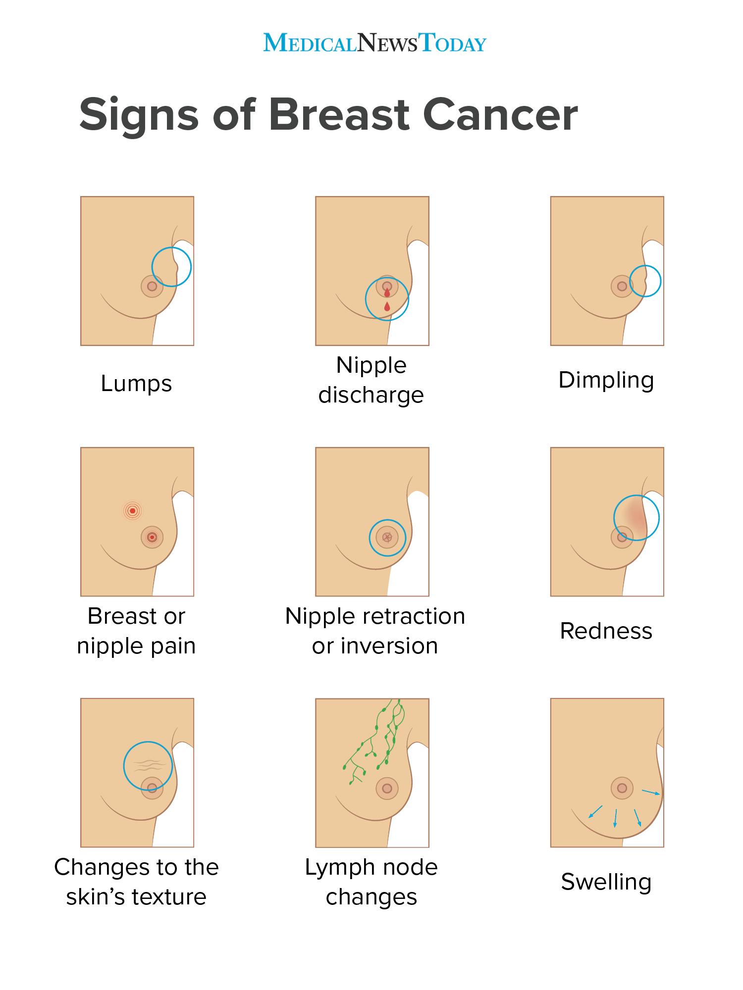 Breast cancer symptoms: Early signs, pictures, and more