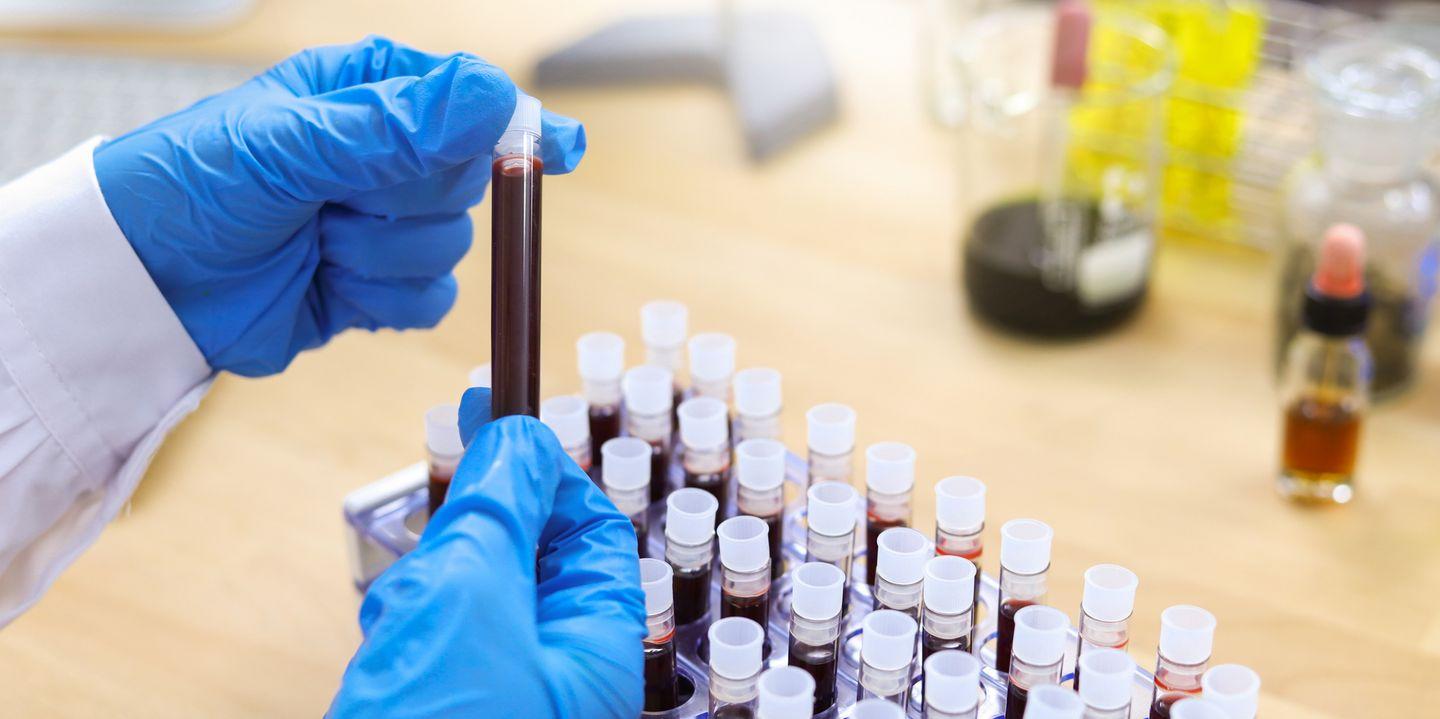Can This Blood Test Really Detect Cancer Years Before ...