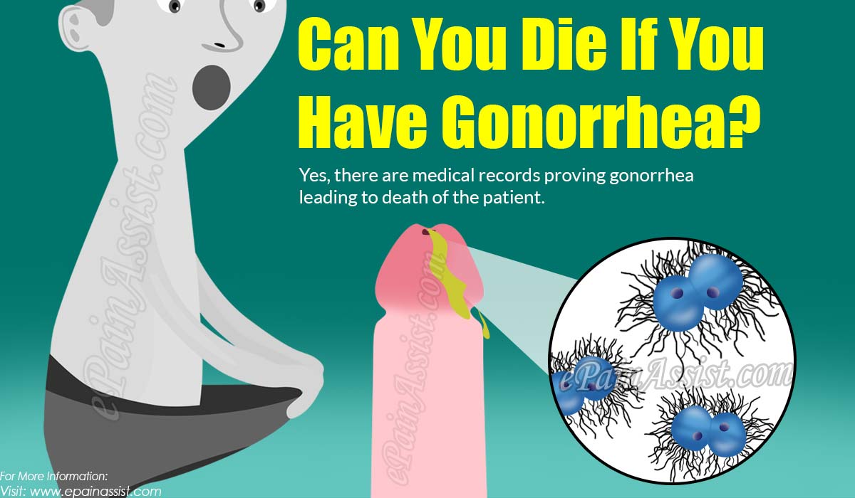 Can You Die If You Have Gonorrhea?