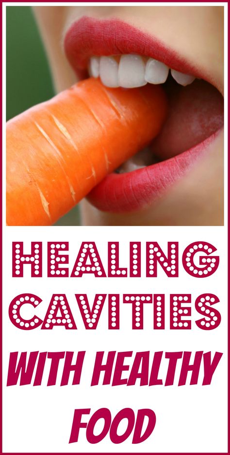 Can You Get Rid Of Cavities On Your Own?