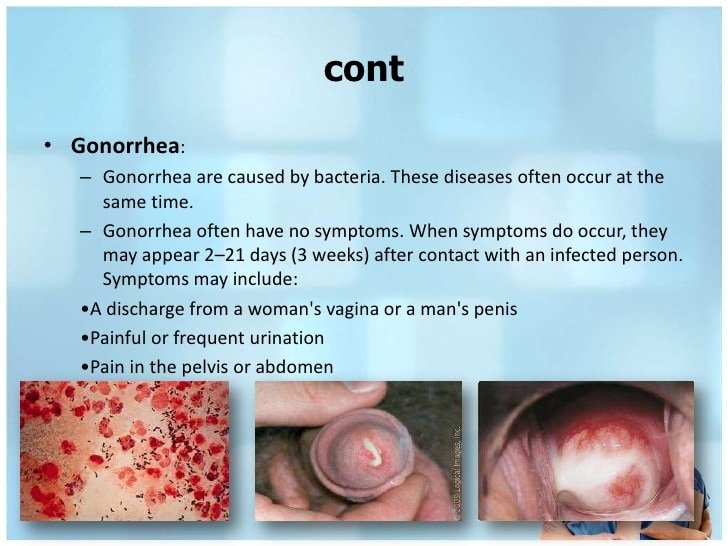 Chlamydia And Gonorrhea In Men