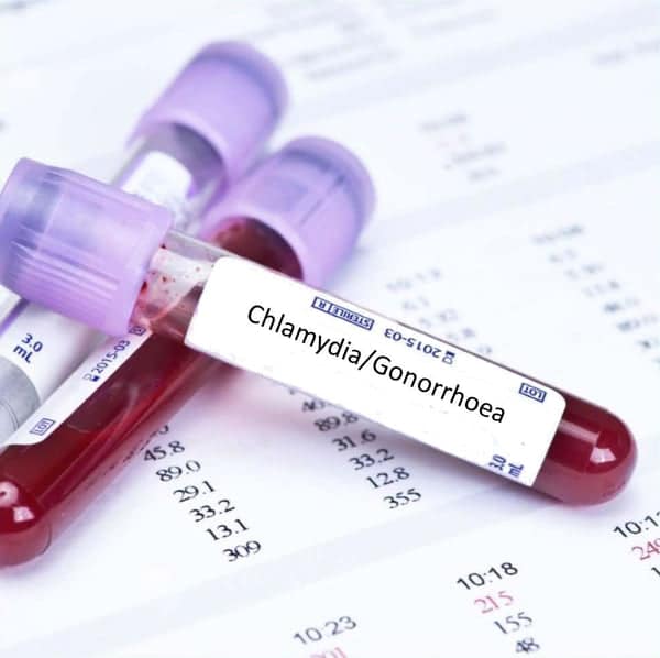 Chlamydia and Gonorrhoea Urine Test Profile