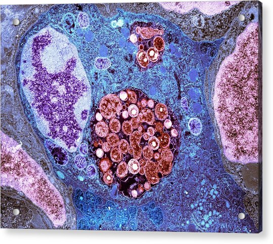 Chlamydia Bacteria In A Lung Cell Photograph by Moredun Animal Health Ltd