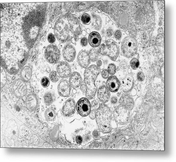 Chlamydia Bacteria In A Lung Cell Photograph by Moredun Animal Health ...
