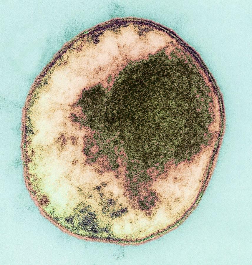 Chlamydia Bacterium, Tem Photograph by Steve Gschmeissner