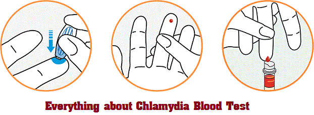 Chlamydia Blood Test Accuracy