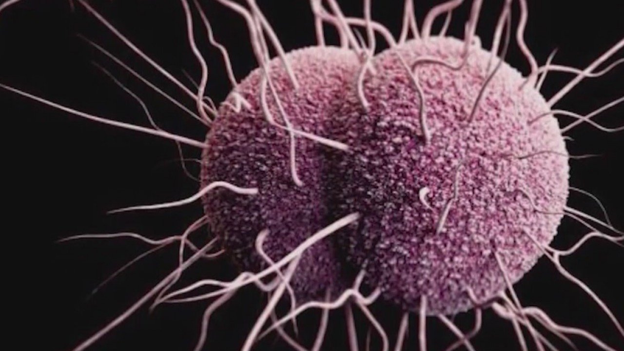 Chlamydia, gonorrhea continue to rise in UT
