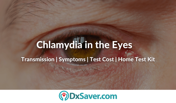 Chlamydia in Eye