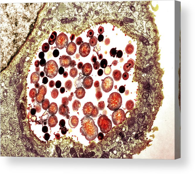 Chlamydia Trachomatis Bacteria, Tem Acrylic Print by Biomedical Imaging ...