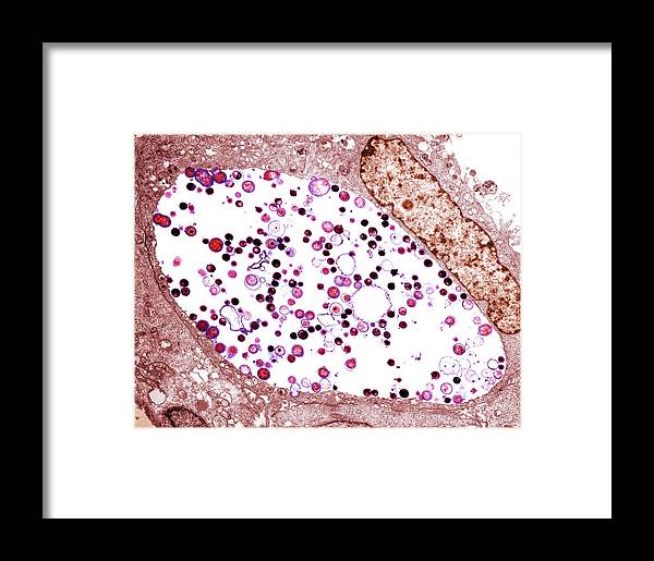 Chlamydia Trachomatis Bacteria, Tem Framed Print by Biomedical Imaging ...