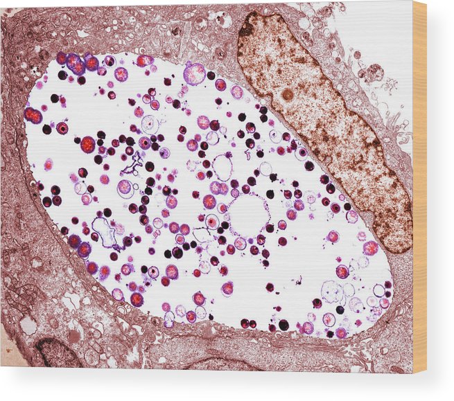 Chlamydia Trachomatis Bacteria, Tem Wood Print by Biomedical Imaging ...