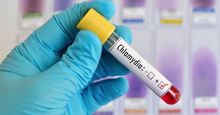 Chlamydia Treatment Online
