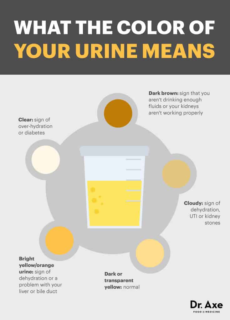 Cloudy Urine Causes and 11 Natural Treatments