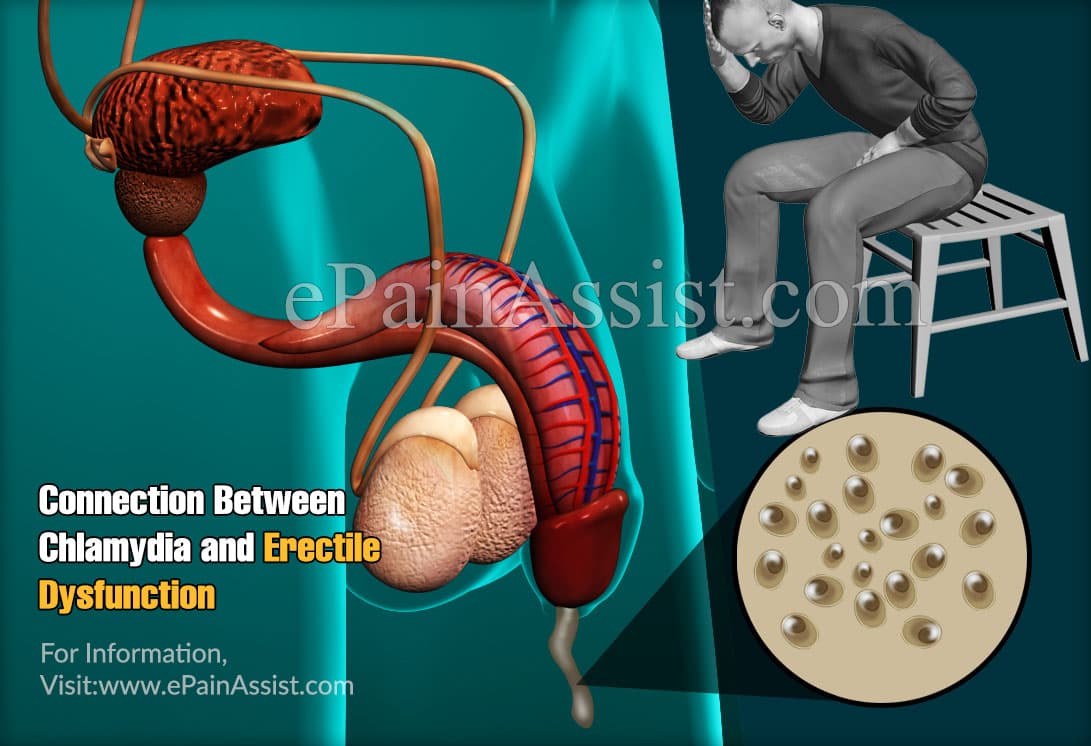Connection Between Chlamydia and Erectile Dysfunction