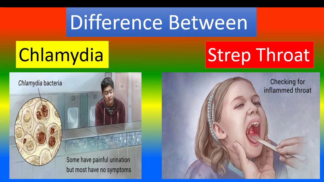 Difference Between Chlamydia and Strep Throat