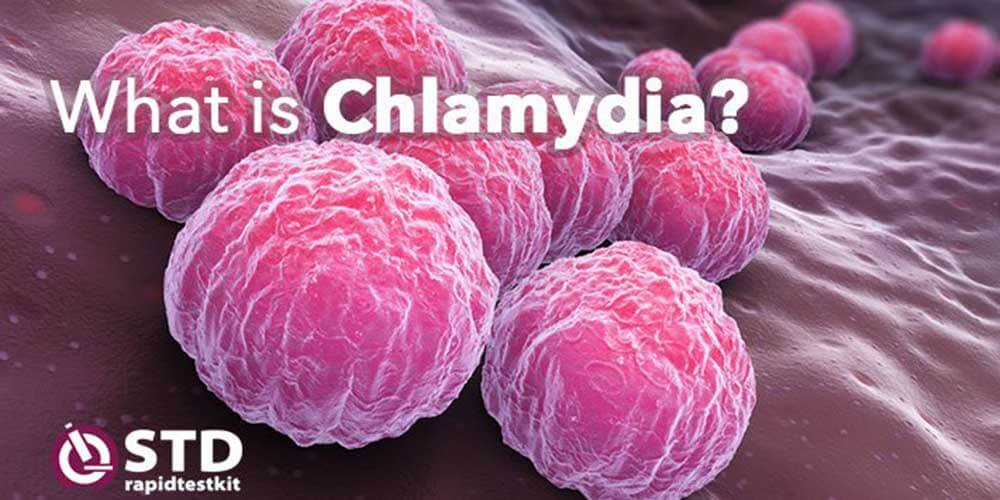 dolliannadesigns: What Happens If Chlamydia Is Left Untreated In Males