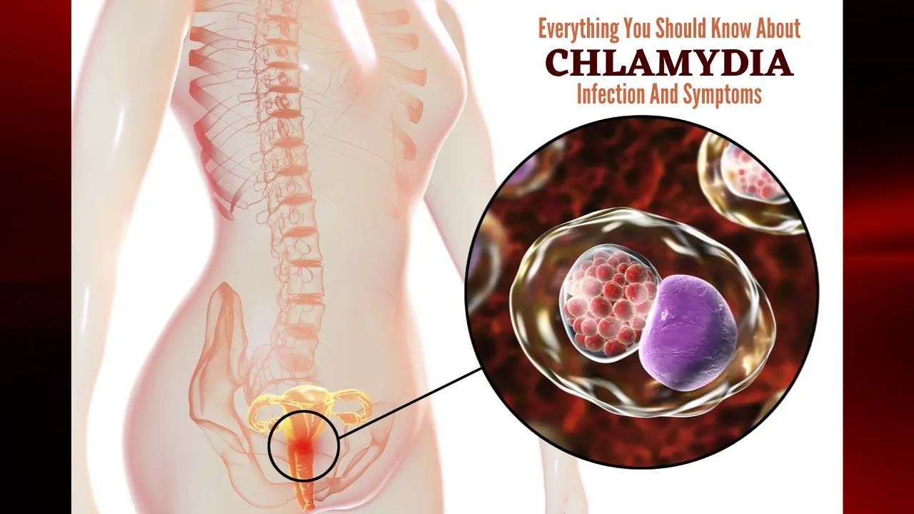 Everything You Should Know About Chlamydia Infection And ...