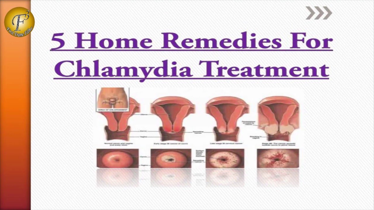 Home cures for chlamydia. Chlamydia Remedies