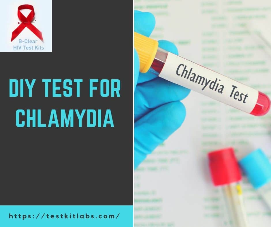 How Do They Test For Chlamydia Female