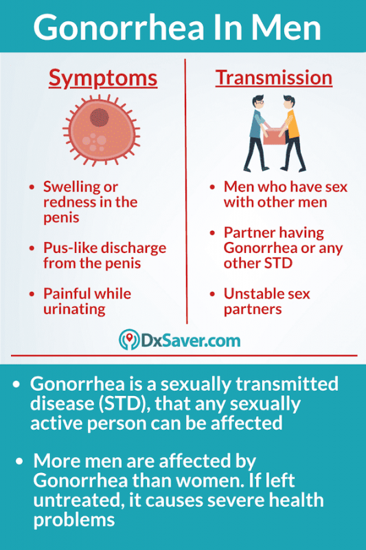 How Long Can You Wait To Treat Gonorrhea â ho.modulartz.com