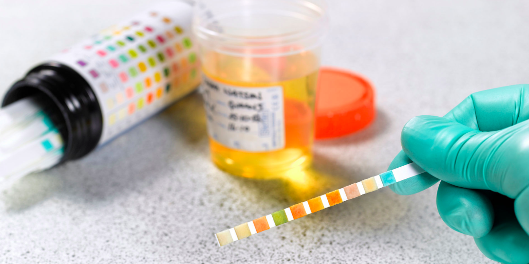 Need to Know: Does CBD Show Up in Drug Tests?