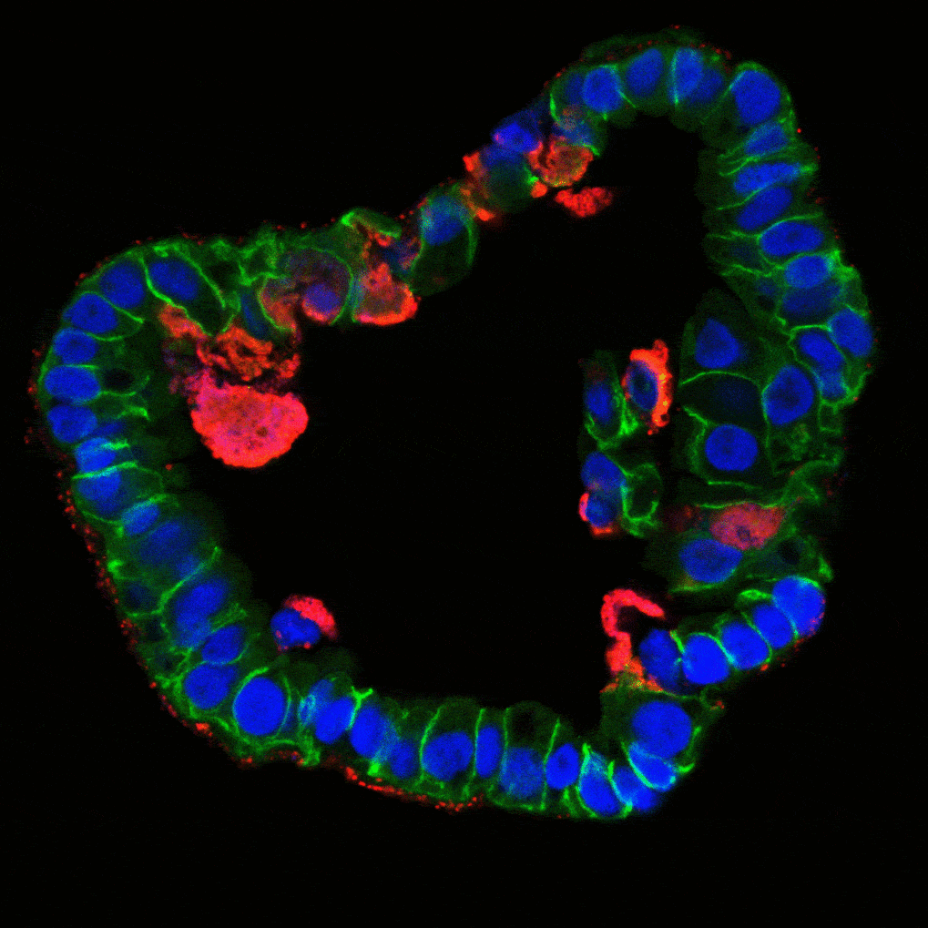 Organoids reveal inflammatory processes in chlamydia infections