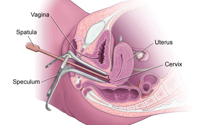 Pap Smear Test Procedure, Results Interpretation