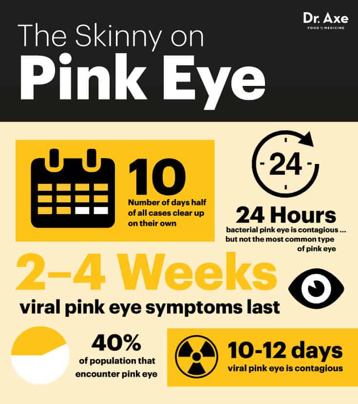 Pink Eye Symptoms (+ 8 Natural Conjunctivitis Remedies)