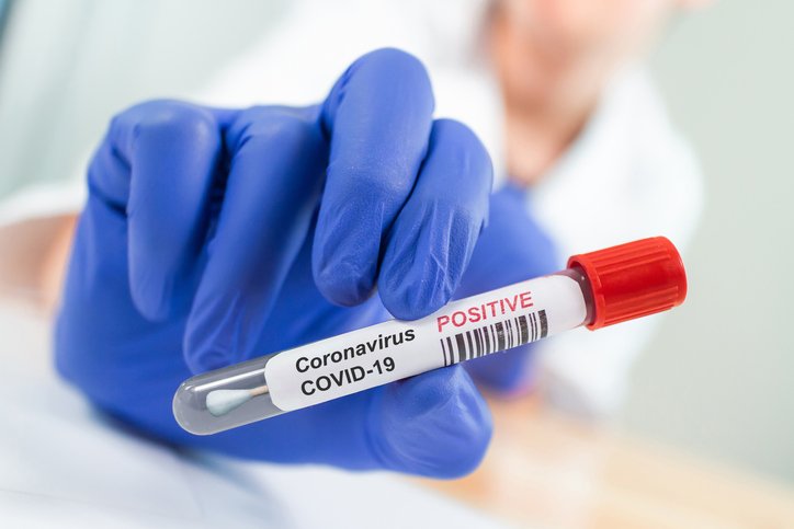 Should You Get Tested or Retested for COVID