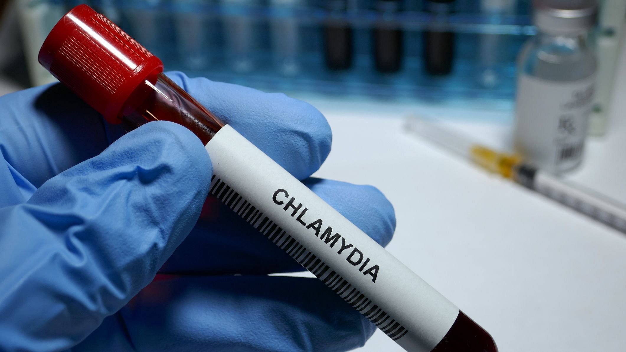 STD: Early Tests of Chlamydia Vaccine Show Promise