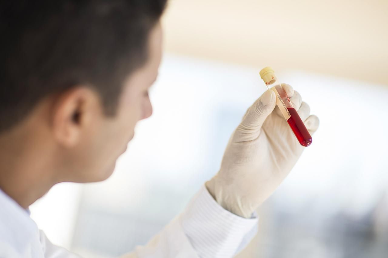 STDs Detected by Blood Tests vs. Urine or Swab Tests