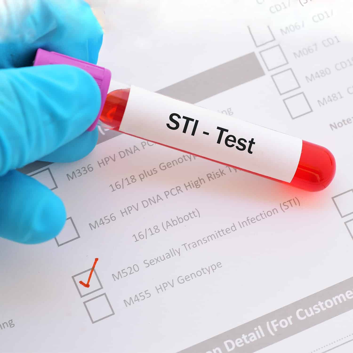 STI Testing &  Treatment â¢ Planned Parenthood Regina