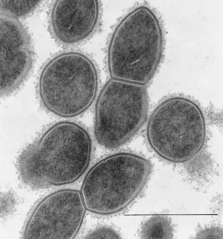 Streptococcus pneumoniae Â» Gram