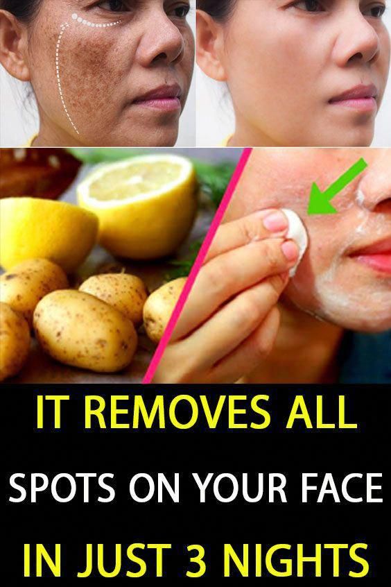 The best way to Get rid of Dark Spots From Experience ...