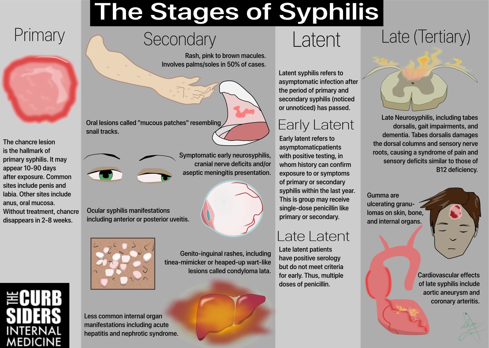 The Stages of Syphilis Primary Syphilis