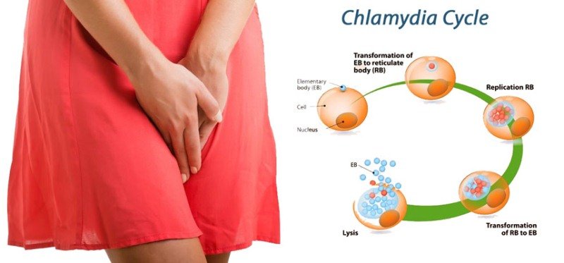 Treatment of Chlamydia in Women