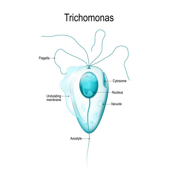 Trichomoniasis : DB Clinic