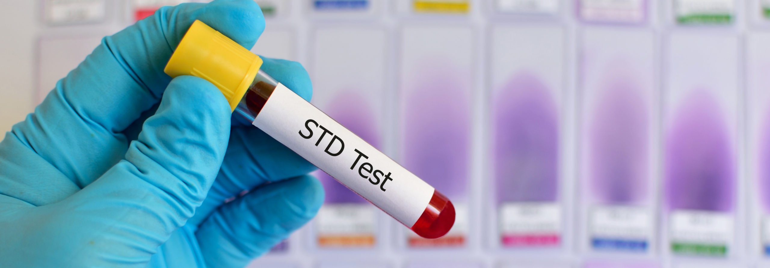 What are the Most Common STDs and How Do You Get Rid of Them?