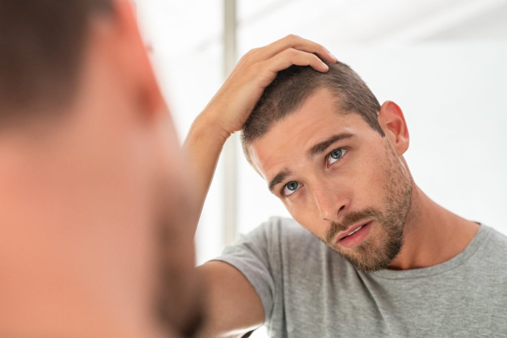 What are the STDs That Cause Hair Loss?  STD Testing ...
