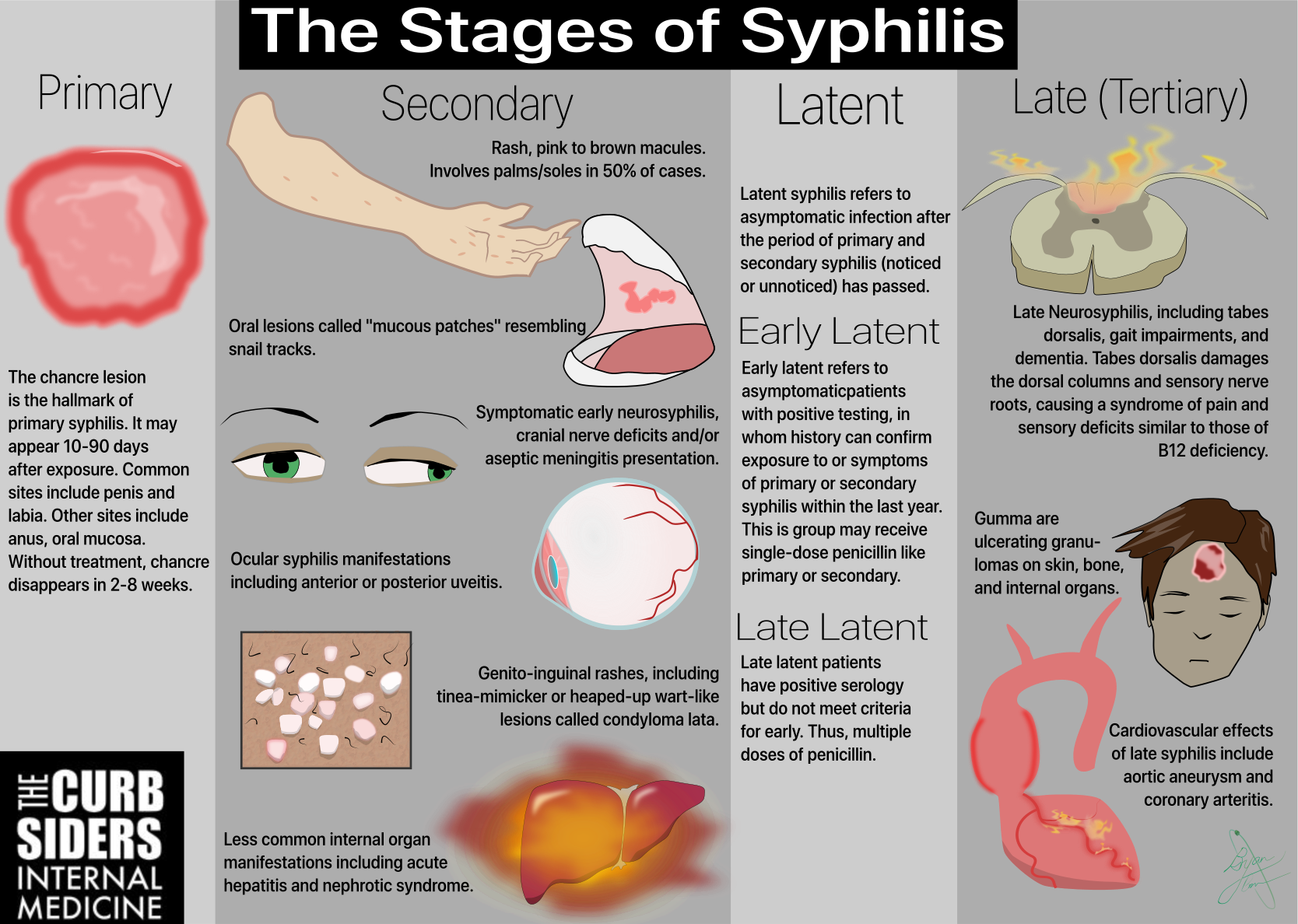 What are the three stages of Syphilis?