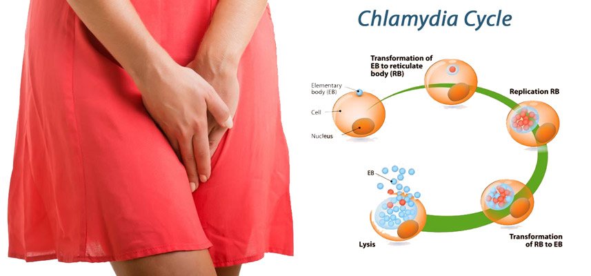 What is Chlamydia, Causes, Symptoms, Prevention and Treatment. Health ...