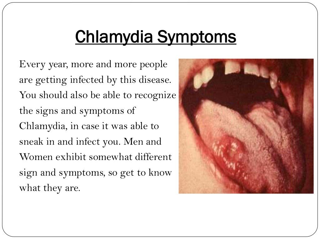 What is Chlamydia disease?