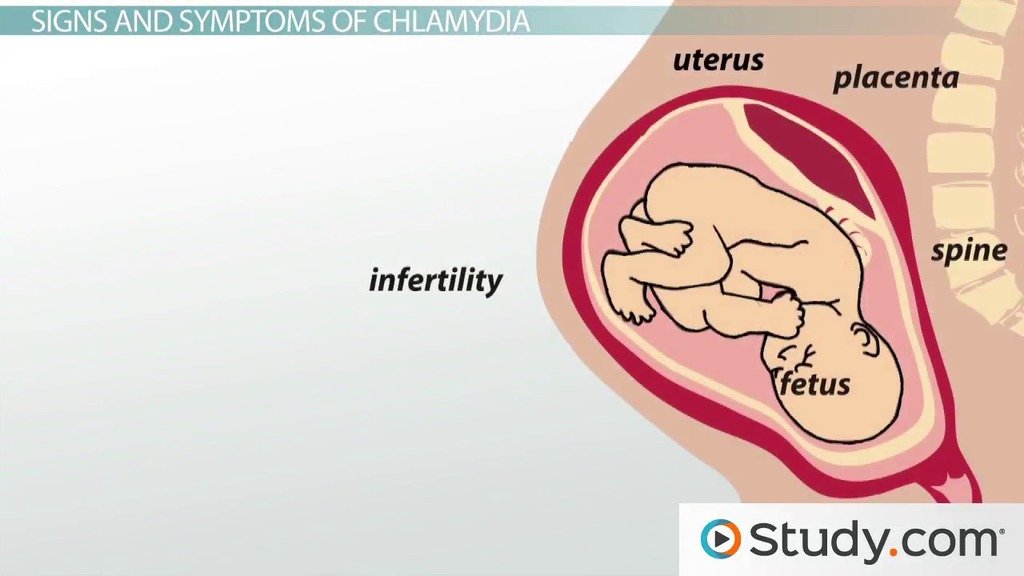 What Is Chlamydia Trachomatis?