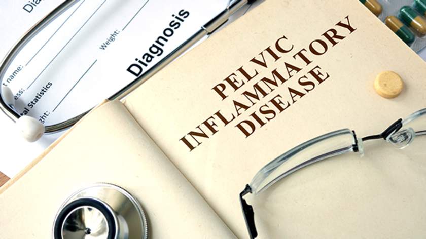 What Is Pelvic Inflammatory Disease?
