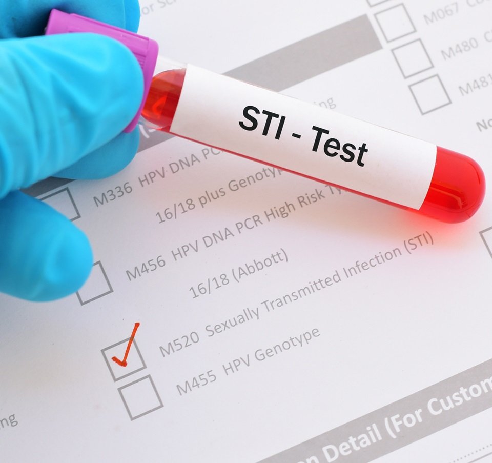 What You Need to Know About Chlamydia Test