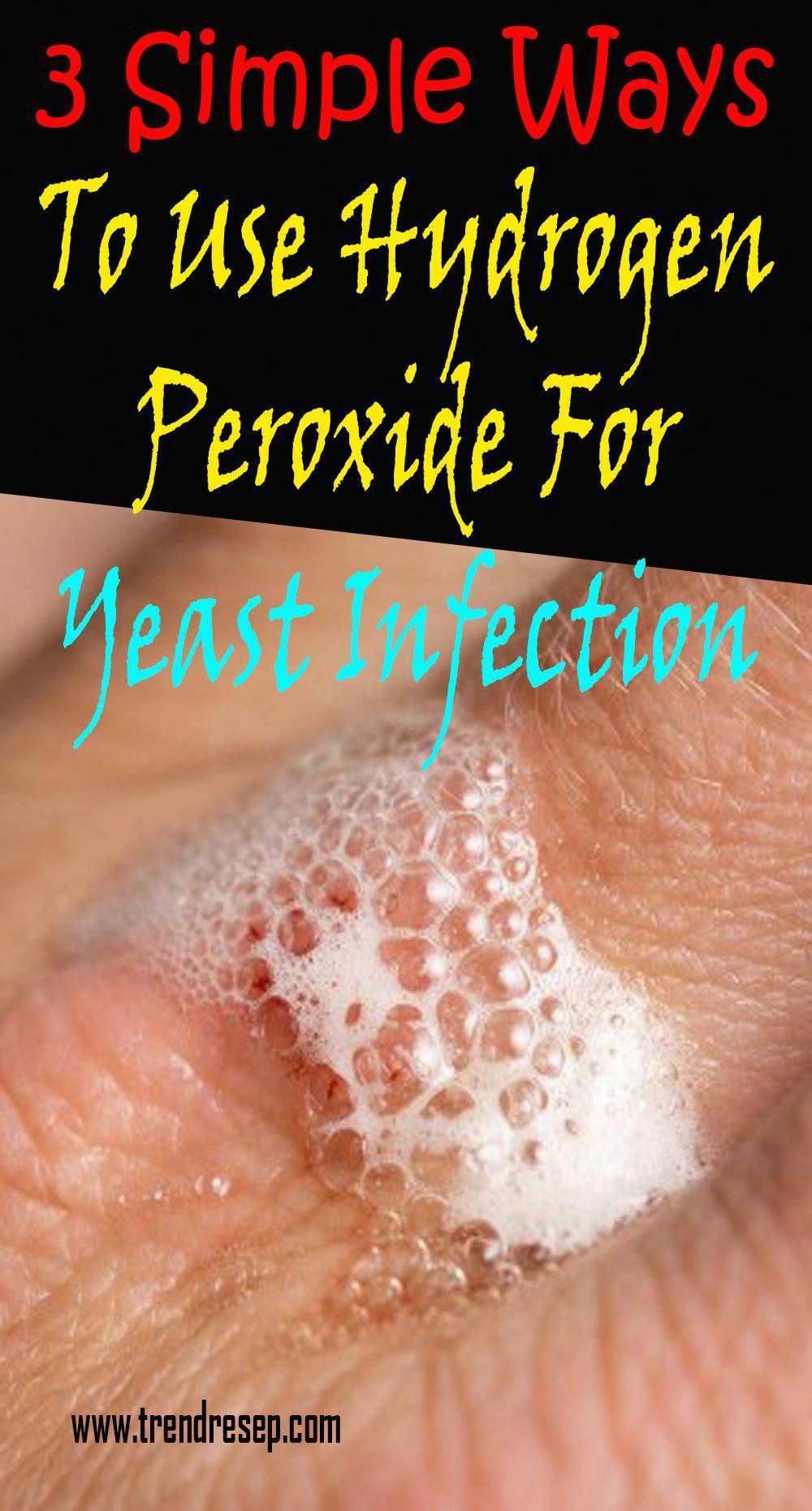 yeast infection creates, Indicators &  Symptoms and also ...